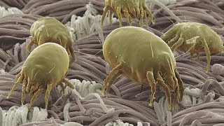 Good Question What Are Dust Mites [upl. by Eulalia]