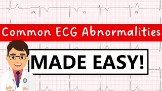 Common ECG abnormalities  MADE EASY [upl. by Geoff]