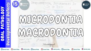 Microdontia  Macrodontia  Developmental disturbances in size of teeth  Dr Paridhi Agrawal [upl. by Moria]