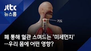 폐 통해 혈관 스며드는 미세먼지…우리 몸에 어떤 영향 [upl. by Nnazus]