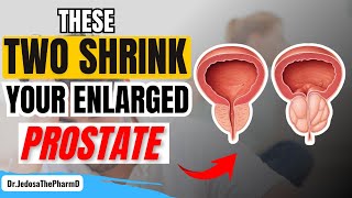 FINASTERIDE and DUTASTERIDE for Shrinking ENLARGED PROSTATE What You Need to Know [upl. by Burchett539]