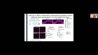 Sofia das Neves Meningeal lymphatic function promotes oligodendrocyte survival amp brain myelination [upl. by Ruhtracam]