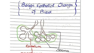 Nonproliferative Disease Benign Epithelial Changes  Breast Pathology [upl. by Steinway]