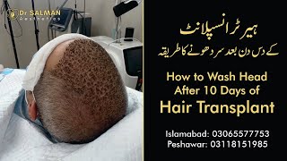 How to Wash Head After 10 Days of FUE Hair Transplant I Dr Salman Aesthetics Ihairwash fue [upl. by Lemmueu]