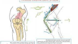 Patellofemoral Joint stress KNEE COMPLEX [upl. by Pruter]