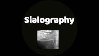 Sialography [upl. by Livvi388]