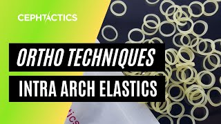 Intra Arch Elastics in Orthodontics [upl. by Della]