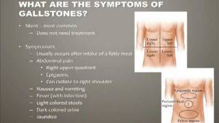 Diseases of the Gallbladder [upl. by Kirven]