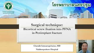 2 Bicortical screw in periimplant fracture DrChavalit [upl. by Maximilien]