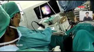 LASER SURGERY FOR KIDNEY STONES IN KARIMNAGAR at ATHARVA UROLOGY hospital by Dr panuganti vivek [upl. by Prochora299]