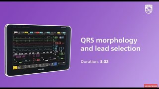 QRS morphology and lead selection at the IntelliVue patient monitor [upl. by Dez517]