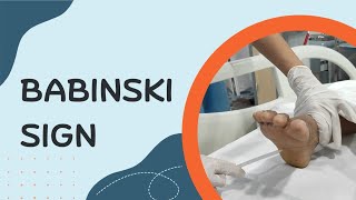 How to Elicit Babinski Sign [upl. by Florian]