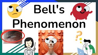 Bells phenomenon  Bell’s reflex  Palpebral oculogyric reflex  Novice Medic [upl. by Mills]