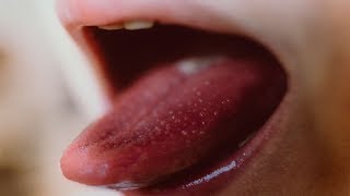 10 Common HIV Symptoms In Women That You Shouldnt Ignore [upl. by Virgilia669]