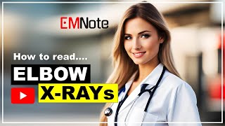 How to Read Elbow Radiograph CRITOE [upl. by Tien863]