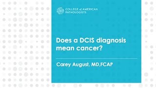 Does a DCIS diagnosis mean cancer [upl. by Izzy]