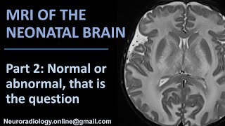 MRI of the neonatal brain part 2 Normal or abnormal that is the question [upl. by Kohcztiy]