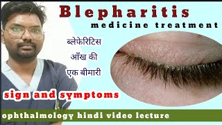 blepharitis treatment  blepharitis  treatment of blepharitis  blepharitis  hindiophthalmology [upl. by Bob]