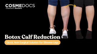 Botox Calf Reduction Quick NonSurgical Solution for Slimmer Legs [upl. by Helyn]