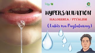 Hypersalivation Labis na Paglalaway Sanhi Sintomas Epekto at LunasHome Remedies [upl. by Ettenwad]