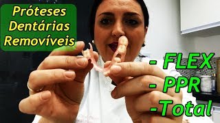 3 Principais Tipos de Prótese Dentária Removível [upl. by Eresed]