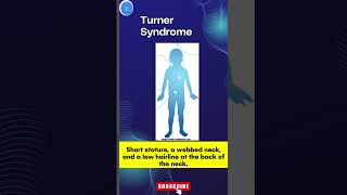 Turner Syndrome A Genetic Disorder Turner Syndrome Awareness [upl. by Jary]