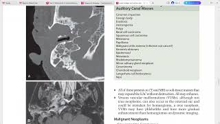 CORE REQUISITES of neuroradiology [upl. by Adamski]