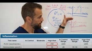 Seizures  what is causing your NonEpileptic Seizures Are they metabolically driven pseudoseizures [upl. by Patt562]