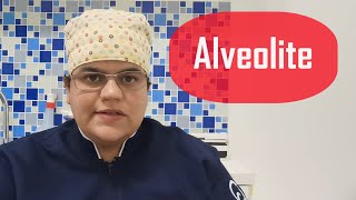 ALVEOLITE o que é Como EVITAR ComoTRATAR  Dra Bianca Rosa [upl. by Jaf]