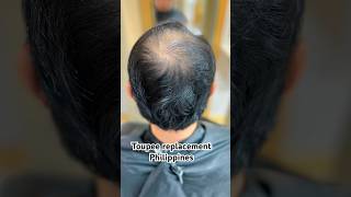 Hair loss no problem hair toupee replacement got you 100human hair natural look toupee [upl. by Griselda]