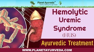 Ayurvedic Treatment of Hemolytic Uremic Syndrome HUS [upl. by Kandy40]