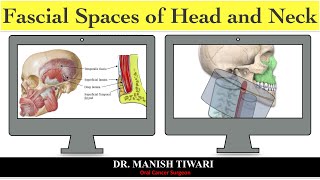 Odontogenic space infection part  1 fascial spaces of head and neck [upl. by Ahsinoj]