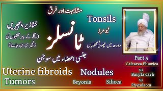 Tonsils problem Uterine fibroids Tumors Nodules  Calcarea fluorica [upl. by Aerehs]