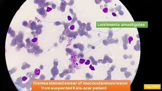 Leishmania amastigotes Microscopy [upl. by Jenness]