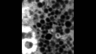 NIDCR Granules in a Salivary Acinar Cell [upl. by Anaid140]