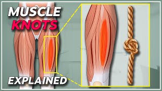 What is a muscle knot  Muscle knots amp trigger points explained [upl. by Nawk]