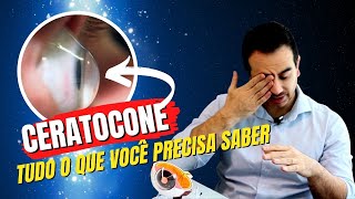 CERATOCONE  TUDO O QUE VOCÊ PRECISA SABER [upl. by Ytitsahc683]