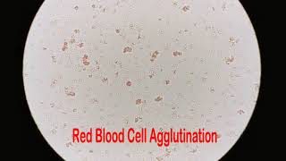 What Are Blood Types ABO Blood Group System  Agglutination Test [upl. by Fredette]