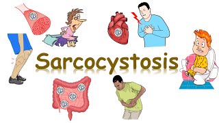 شرح Sarcosporidiosis sarcocystis [upl. by Garretson]