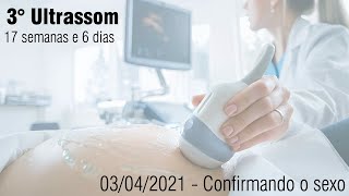 3° ultrassom  17 semanas e 6 dias [upl. by Babara]