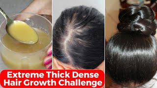 30 Days Extreme Thick Hair Growth ChallengeIncrease Hair Density amp thicknessपतले बालों को घना करे [upl. by Tawsha]