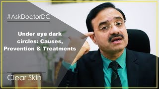 Under eye dark circles Causes Prevention amp Treatments English [upl. by Aierbma654]