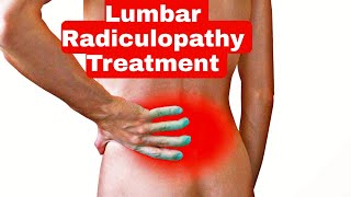 Best Treatment for Lumbar Radiculopathy  Nerve pain  Exercise for Radiated Pain in legs [upl. by Timmy]