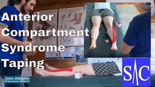 Easy guide on how to tape anterior compartment syndrome [upl. by Yentirb734]