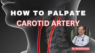 Carotid artery palpation method  Dr Arvind Kumar [upl. by Doble]