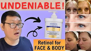 Is ADVANCED CLINICALS RETINOL ADVANCED FIRMING CREAM still good now  February 2024 [upl. by Airetahs850]