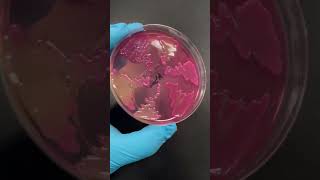 Acinetobacter baumannii is pretty 😊 [upl. by Wachtel539]