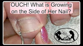 Pedicure Tutorial What Mimics Ingrown Toenail Pain Pro Tools Available on My Online Store ✔️ [upl. by Peggie]