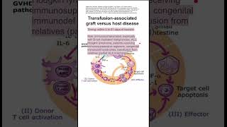 Transfusionassociated graft versus host disease [upl. by Dorwin]