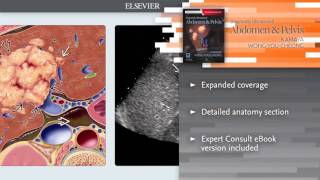 Diagnostic Ultrasound Abdomen and Pelvis [upl. by Brian]